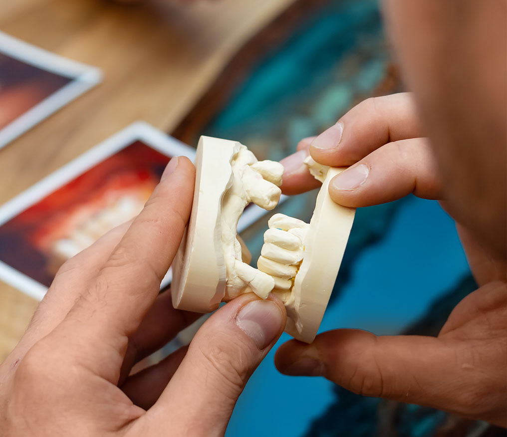 Przeszczep kości chirurgia stomatologiczna Lublin